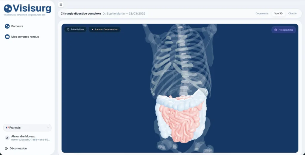 VisiSurg visualisation 3D du corps humain